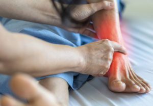 Common Running Injury: Stress Fractures of the Foot